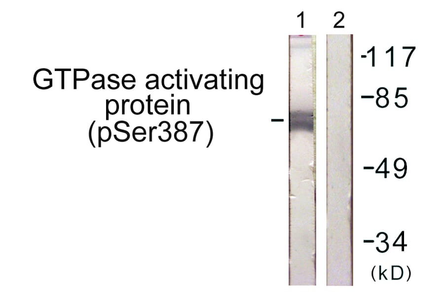 Western Blot - Anti-GTPase Activating Protein (phospho Ser387) Antibody (A1032) - Antibodies.com