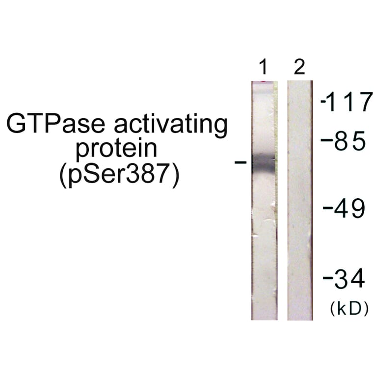 Western Blot - Anti-GTPase Activating Protein (phospho Ser387) Antibody (A1032) - Antibodies.com