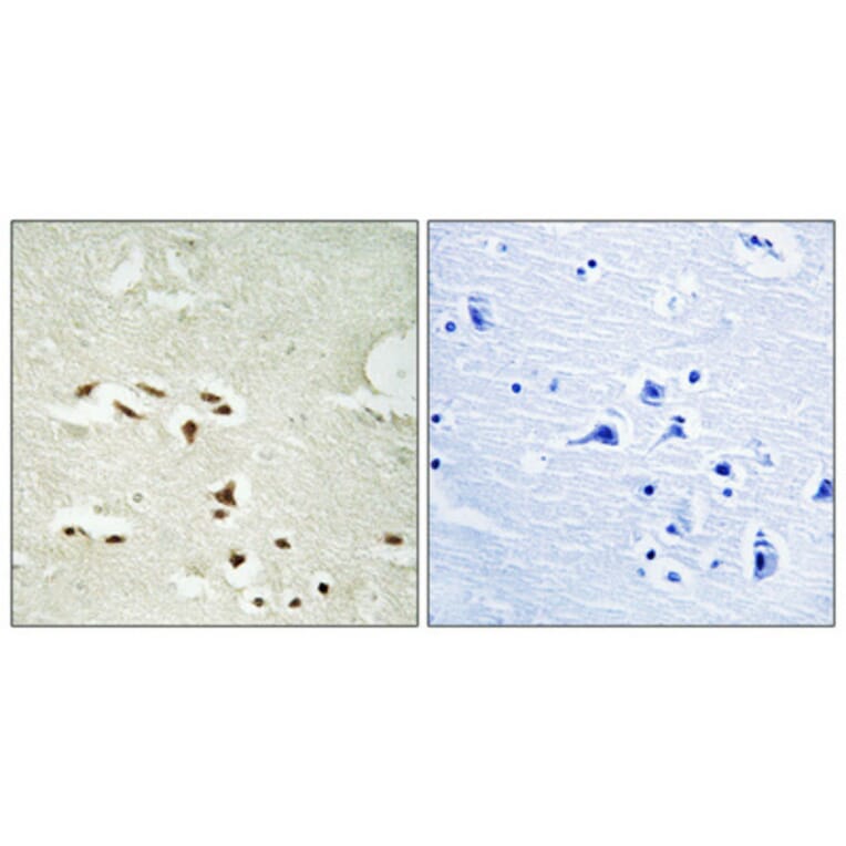 Immunohistochemistry - Anti-Proteasome alpha3 (phospho Ser250) Antibody (A1229) - Antibodies.com