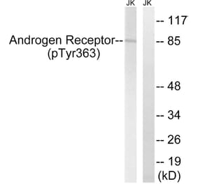 Western Blot - Anti-Androgen Receptor (phospho Tyr363) Antibody (A8204) - Antibodies.com