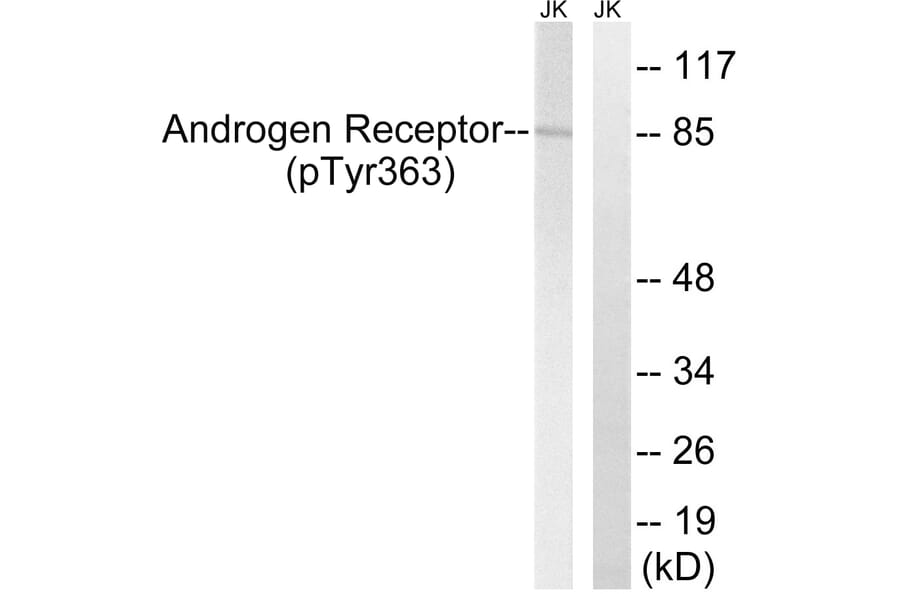 Western Blot - Anti-Androgen Receptor (phospho Tyr363) Antibody (A8204) - Antibodies.com