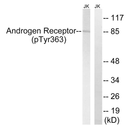 Western Blot - Anti-Androgen Receptor (phospho Tyr363) Antibody (A8204) - Antibodies.com