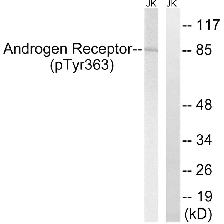 Western Blot - Anti-Androgen Receptor (phospho Tyr363) Antibody (A8204) - Antibodies.com