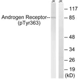 Western Blot - Anti-Androgen Receptor (phospho Tyr363) Antibody (A8204) - Antibodies.com