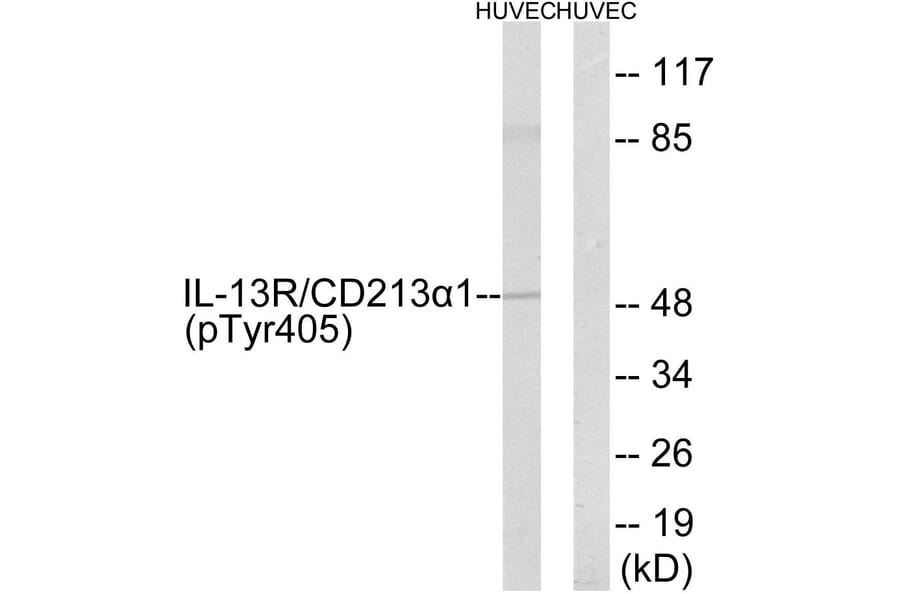 Western Blot - Anti-IL-13R alpha1 (phospho Tyr405) Antibody (A1057) - Antibodies.com