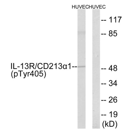 Western Blot - Anti-IL-13R alpha1 (phospho Tyr405) Antibody (A1057) - Antibodies.com