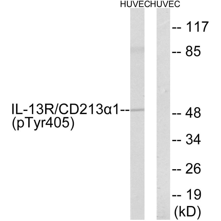 Western Blot - Anti-IL-13R alpha1 (phospho Tyr405) Antibody (A1057) - Antibodies.com