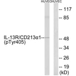 Western Blot - Anti-IL-13R alpha1 (phospho Tyr405) Antibody (A1057) - Antibodies.com