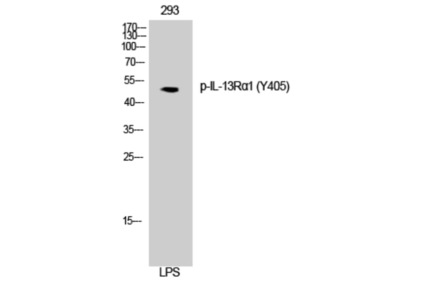 Western Blot - Anti-IL-13R alpha1 (phospho Tyr405) Antibody (A1057) - Antibodies.com