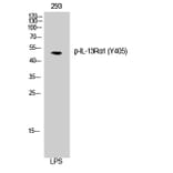 Western Blot - Anti-IL-13R alpha1 (phospho Tyr405) Antibody (A1057) - Antibodies.com