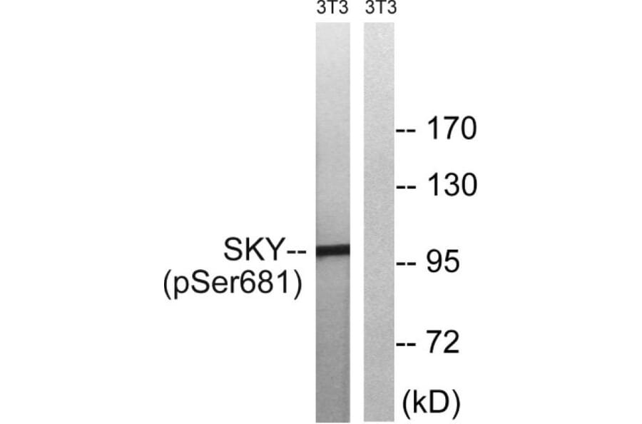 Western Blot - Anti-MER (phospho Tyr749 + Tyr681) Antibody (A8138) - Antibodies.com