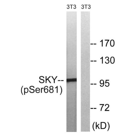 Western Blot - Anti-MER (phospho Tyr749 + Tyr681) Antibody (A8138) - Antibodies.com