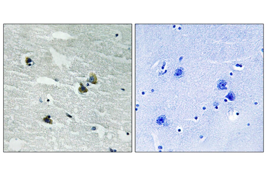 Immunohistochemistry - Anti-MER (phospho Tyr749 + Tyr681) Antibody (A8138) - Antibodies.com