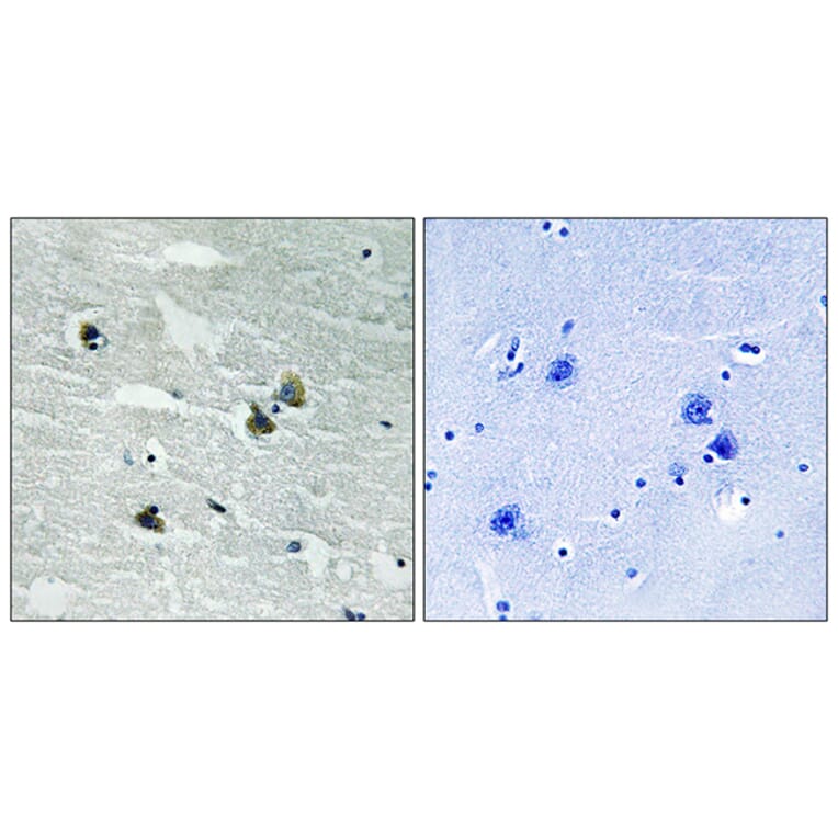 Immunohistochemistry - Anti-MER (phospho Tyr749 + Tyr681) Antibody (A8138) - Antibodies.com
