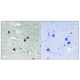 Immunohistochemistry - Anti-MER (phospho Tyr749 + Tyr681) Antibody (A8138) - Antibodies.com