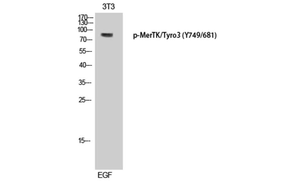 Western Blot - Anti-MER (phospho Tyr749 + Tyr681) Antibody (A8138) - Antibodies.com