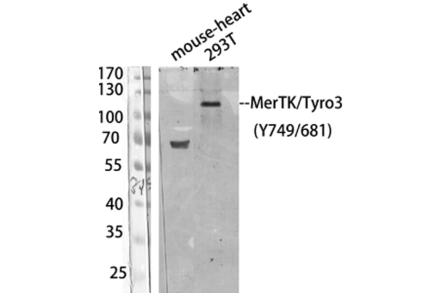 Western Blot - Anti-MER (phospho Tyr749 + Tyr681) Antibody (A8138) - Antibodies.com
