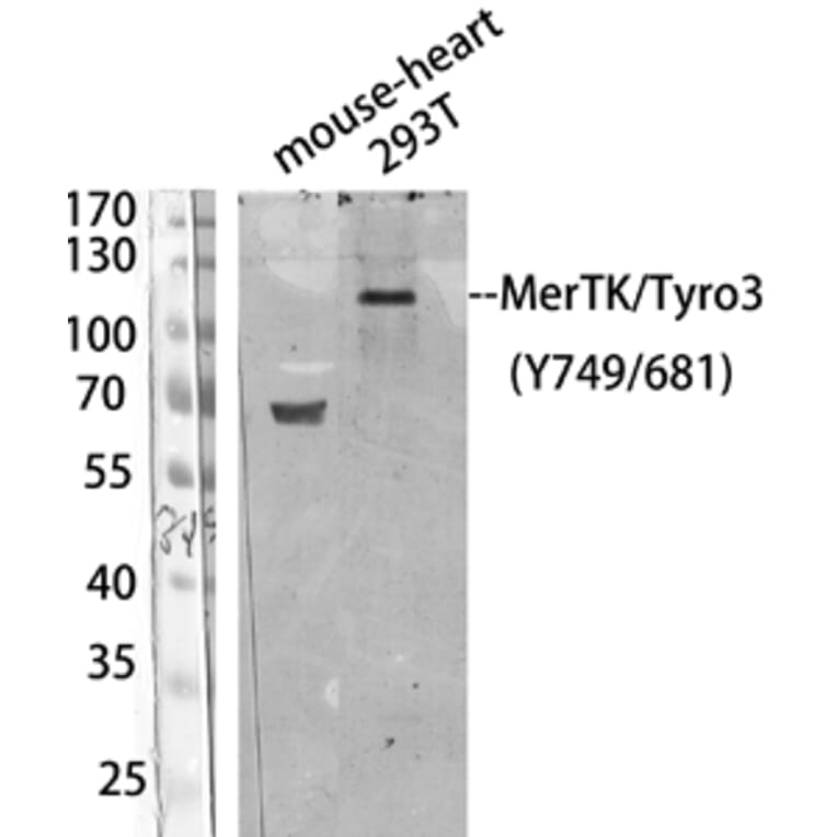 Western Blot - Anti-MER (phospho Tyr749 + Tyr681) Antibody (A8138) - Antibodies.com