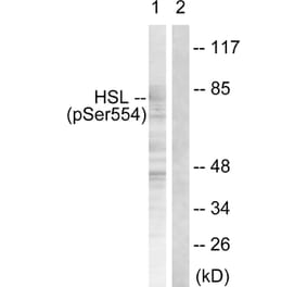 Western Blot - Anti-HSL (phospho Ser855 + Ser554) Antibody (A0074) - Antibodies.com