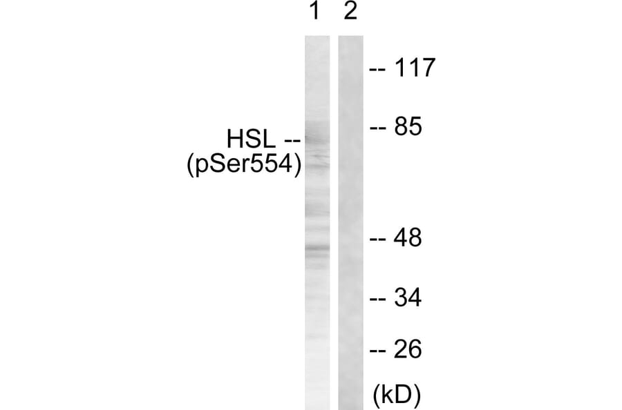 Western Blot - Anti-HSL (phospho Ser855 + Ser554) Antibody (A0074) - Antibodies.com