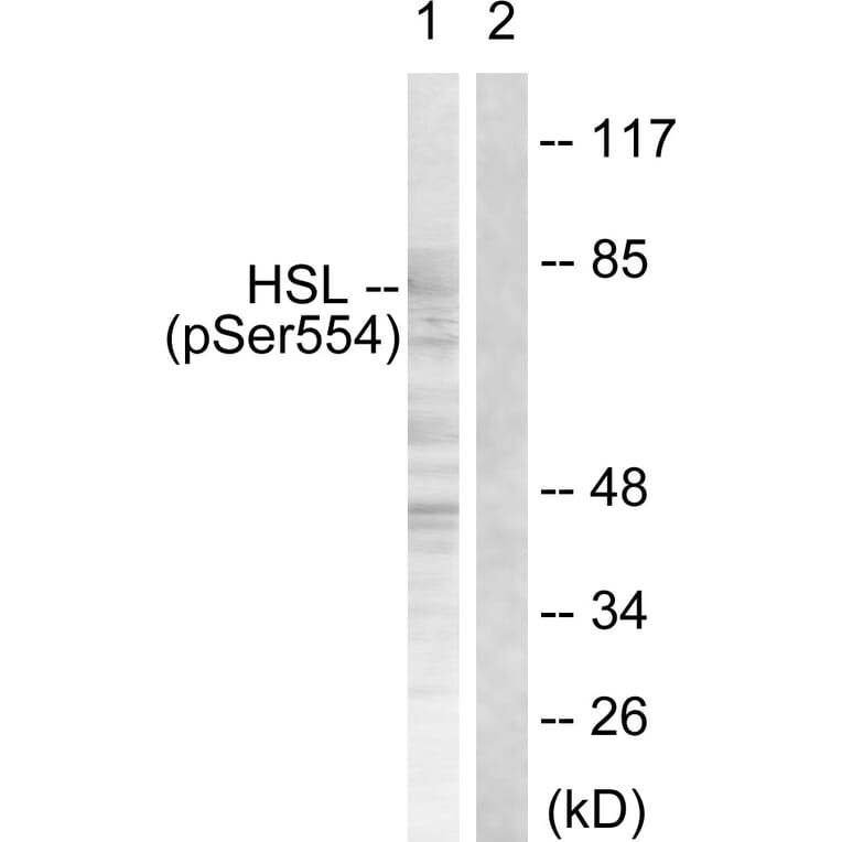 Western Blot - Anti-HSL (phospho Ser855 + Ser554) Antibody (A0074) - Antibodies.com