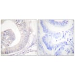 Immunohistochemistry - Anti-HSL (phospho Ser855 + Ser554) Antibody (A0074) - Antibodies.com