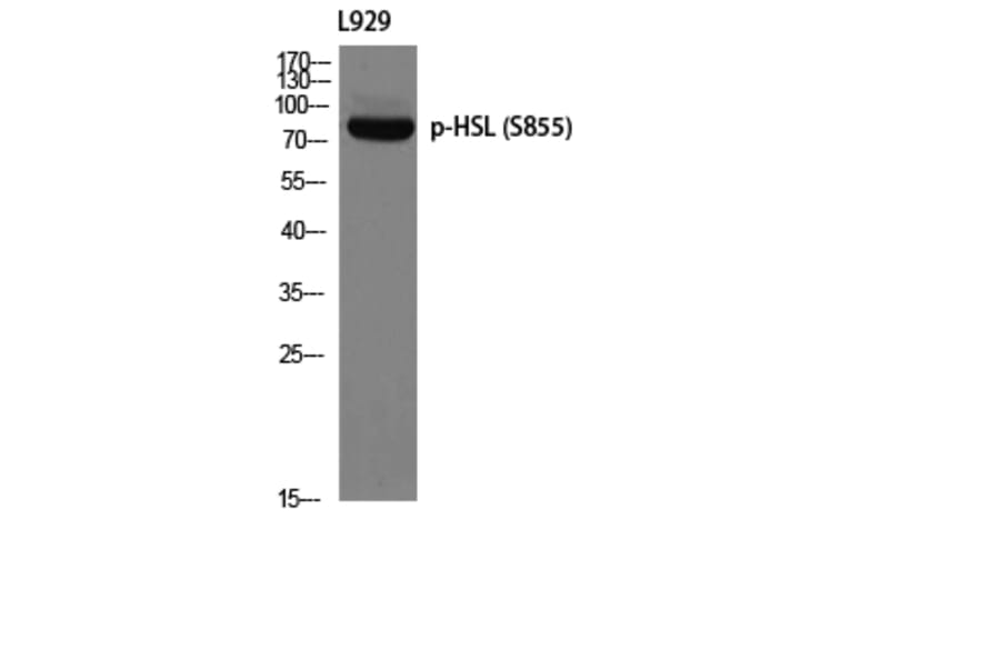 Western Blot - Anti-HSL (phospho Ser855 + Ser554) Antibody (A0074) - Antibodies.com