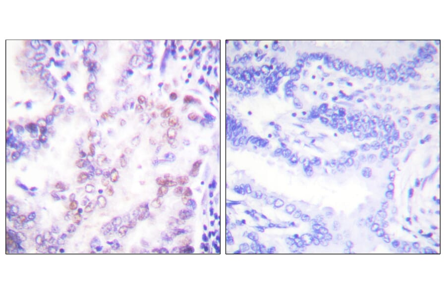 Immunohistochemistry - Anti-Thyroid Hormone Receptor beta Antibody (C0346) - Antibodies.com