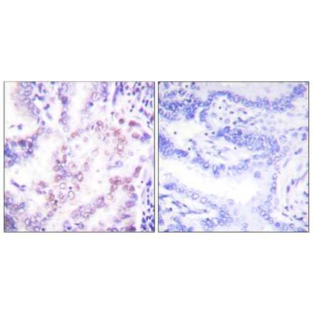 Immunohistochemistry - Anti-Thyroid Hormone Receptor beta Antibody (C0346) - Antibodies.com