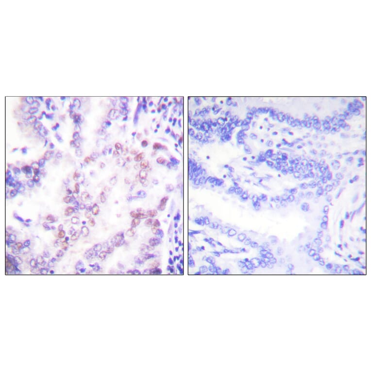 Immunohistochemistry - Anti-Thyroid Hormone Receptor beta Antibody (C0346) - Antibodies.com