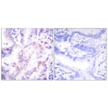 Immunohistochemistry - Anti-Thyroid Hormone Receptor beta Antibody (C0346) - Antibodies.com