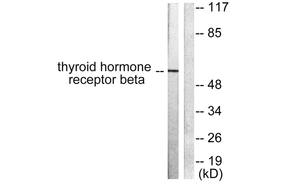 Western Blot - Anti-Thyroid Hormone Receptor beta Antibody (C0346) - Antibodies.com