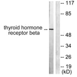 Western Blot - Anti-Thyroid Hormone Receptor beta Antibody (C0346) - Antibodies.com
