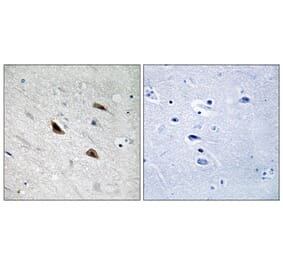 Immunohistochemistry - Anti-Catenin-beta (phospho Tyr489) Antibody (A8009) - Antibodies.com
