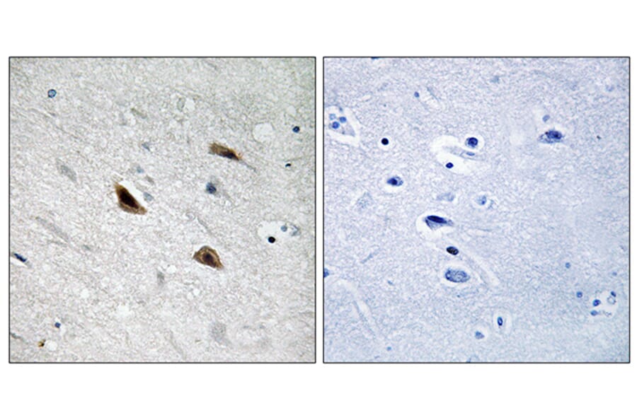 Immunohistochemistry - Anti-Catenin-beta (phospho Tyr489) Antibody (A8009) - Antibodies.com