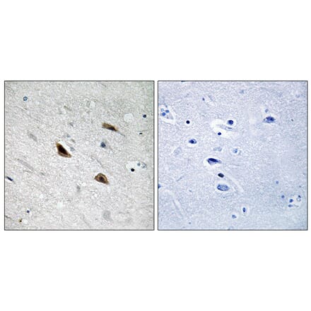 Immunohistochemistry - Anti-Catenin-beta (phospho Tyr489) Antibody (A8009) - Antibodies.com