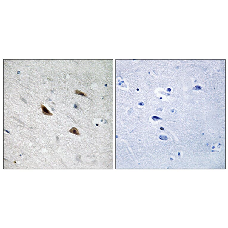 Immunohistochemistry - Anti-Catenin-beta (phospho Tyr489) Antibody (A8009) - Antibodies.com