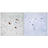Immunohistochemistry - Anti-Catenin-beta (phospho Tyr489) Antibody (A8009) - Antibodies.com