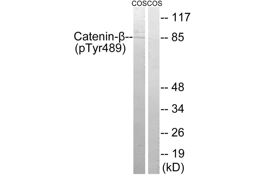 Western Blot - Anti-Catenin-beta (phospho Tyr489) Antibody (A8009) - Antibodies.com
