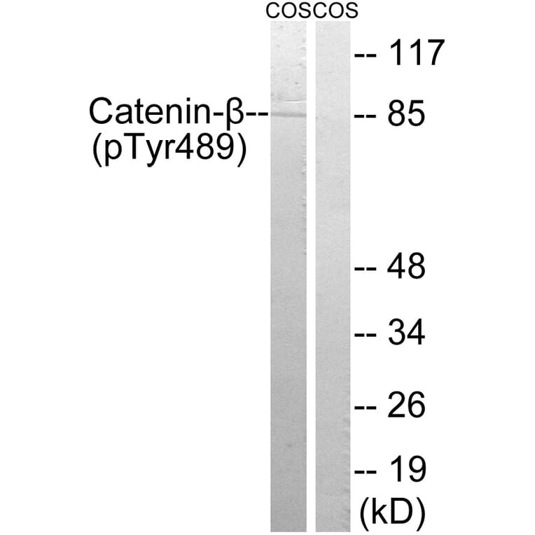 Western Blot - Anti-Catenin-beta (phospho Tyr489) Antibody (A8009) - Antibodies.com