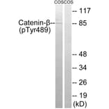 Western Blot - Anti-Catenin-beta (phospho Tyr489) Antibody (A8009) - Antibodies.com