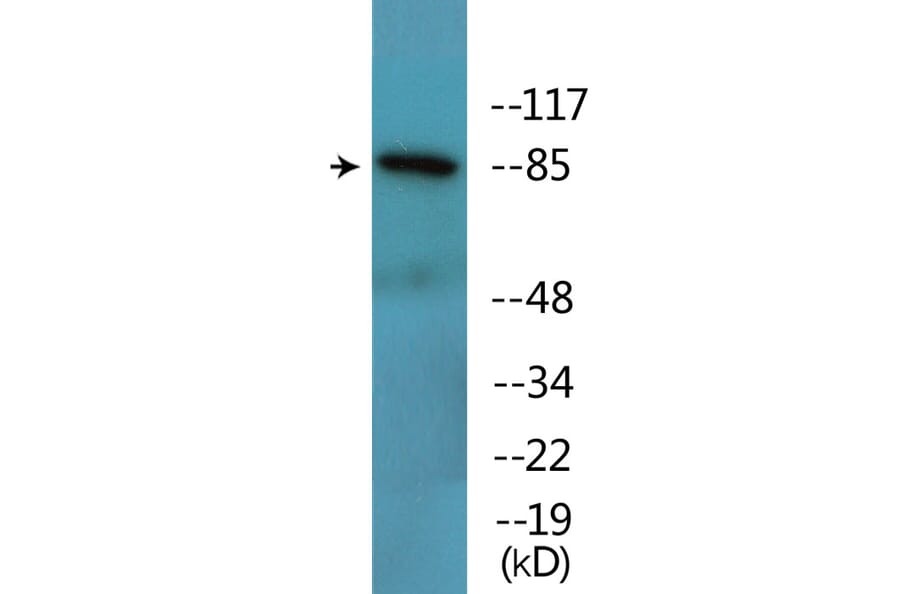Western Blot - Anti-Catenin-beta (phospho Tyr489) Antibody (P12-1086) - Antibodies.com