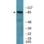 Western Blot - Anti-Catenin-beta (phospho Tyr489) Antibody (P12-1086) - Antibodies.com