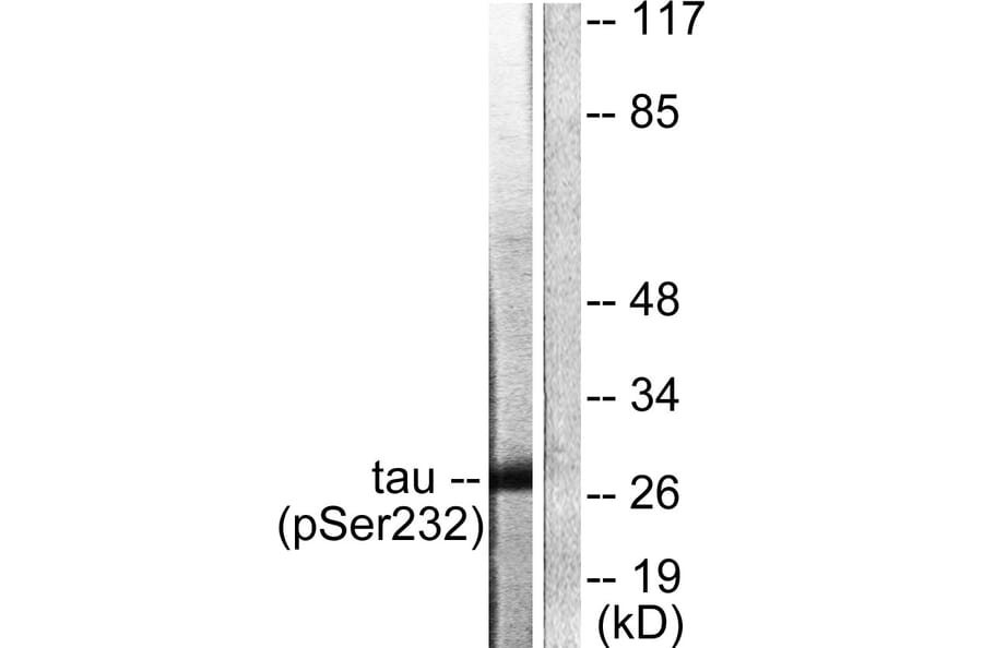 Western Blot - Anti-14-3-3 theta (phospho Ser232) Antibody (A0758) - Antibodies.com