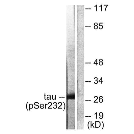 Western Blot - Anti-14-3-3 theta (phospho Ser232) Antibody (A0758) - Antibodies.com