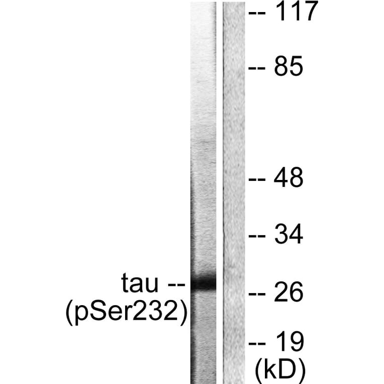 Western Blot - Anti-14-3-3 theta (phospho Ser232) Antibody (A0758) - Antibodies.com