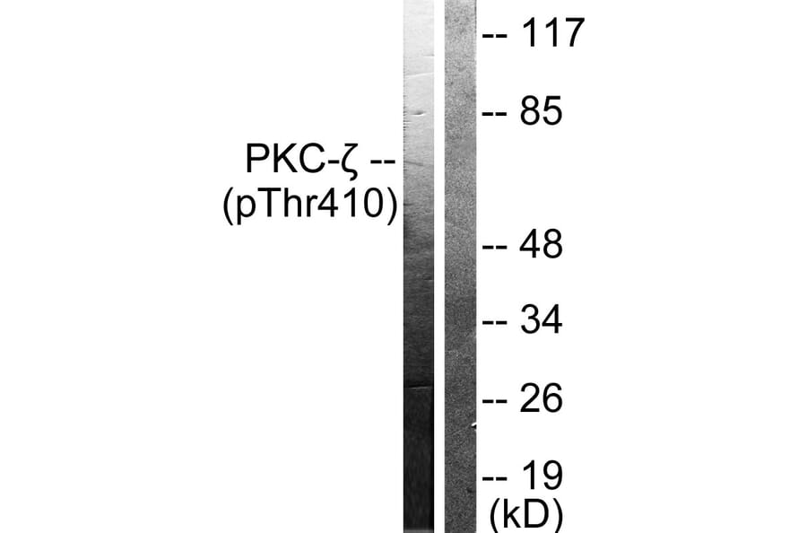 Western Blot - Anti-PKC zeta (phospho Thr410) Antibody (A0023) - Antibodies.com