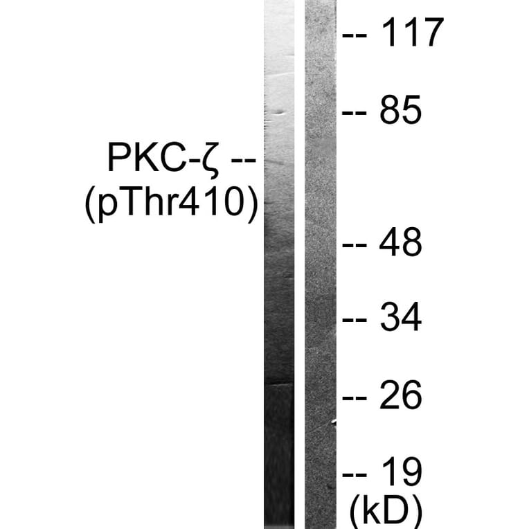 Western Blot - Anti-PKC zeta (phospho Thr410) Antibody (A0023) - Antibodies.com