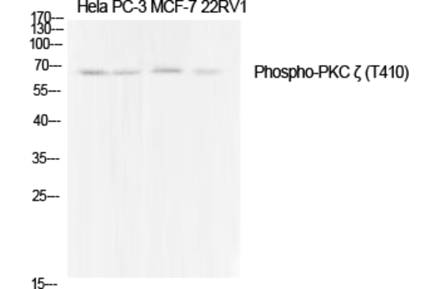 Western Blot - Anti-PKC zeta (phospho Thr410) Antibody (A0023) - Antibodies.com
