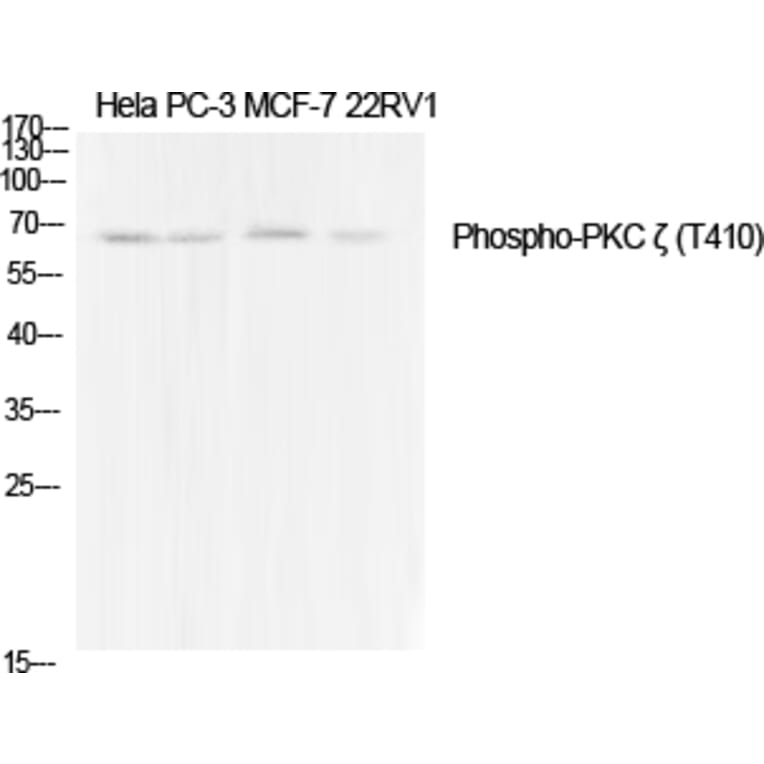 Western Blot - Anti-PKC zeta (phospho Thr410) Antibody (A0023) - Antibodies.com